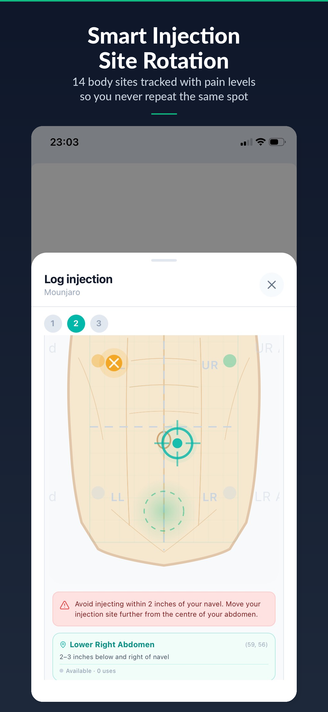 Injection site rotation body map